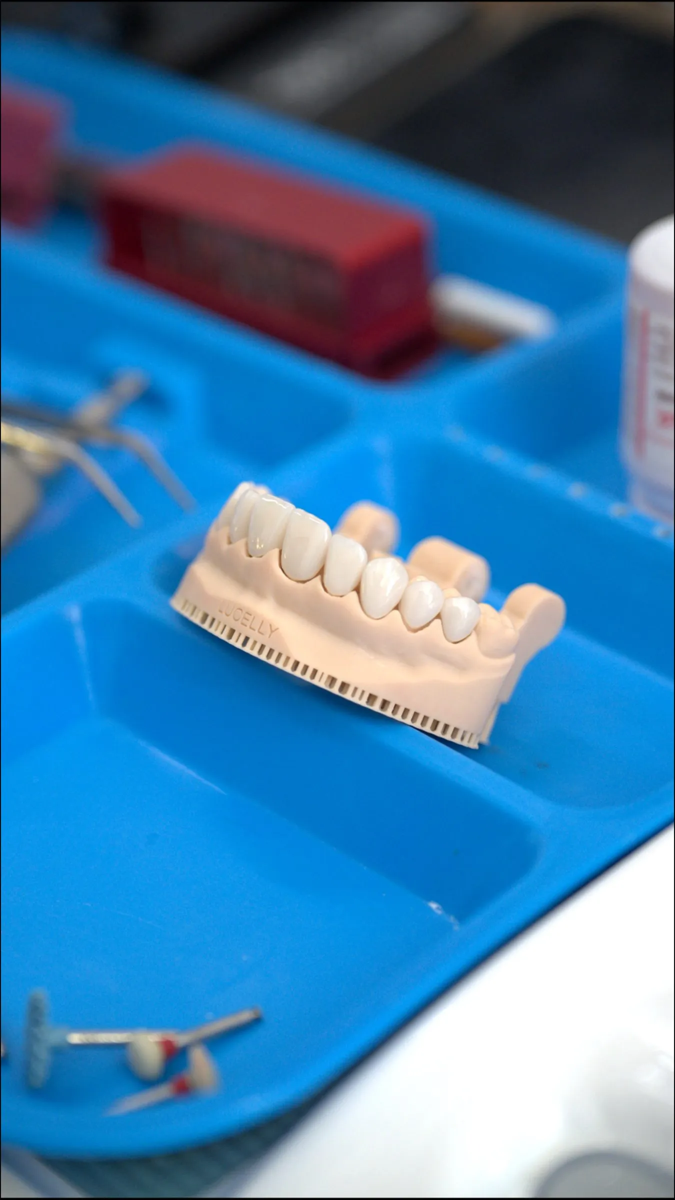 Modelo dental con una hilera de coronas de porcelana blanca sobre una charola azul, rodeado de instrumental odontológico.