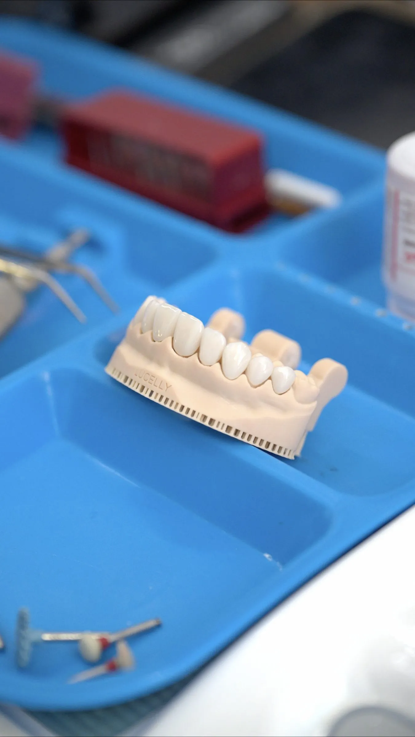 Modelo dental y equipo de trabajo sobre bandeja azul, limpieza y tecnología visibles