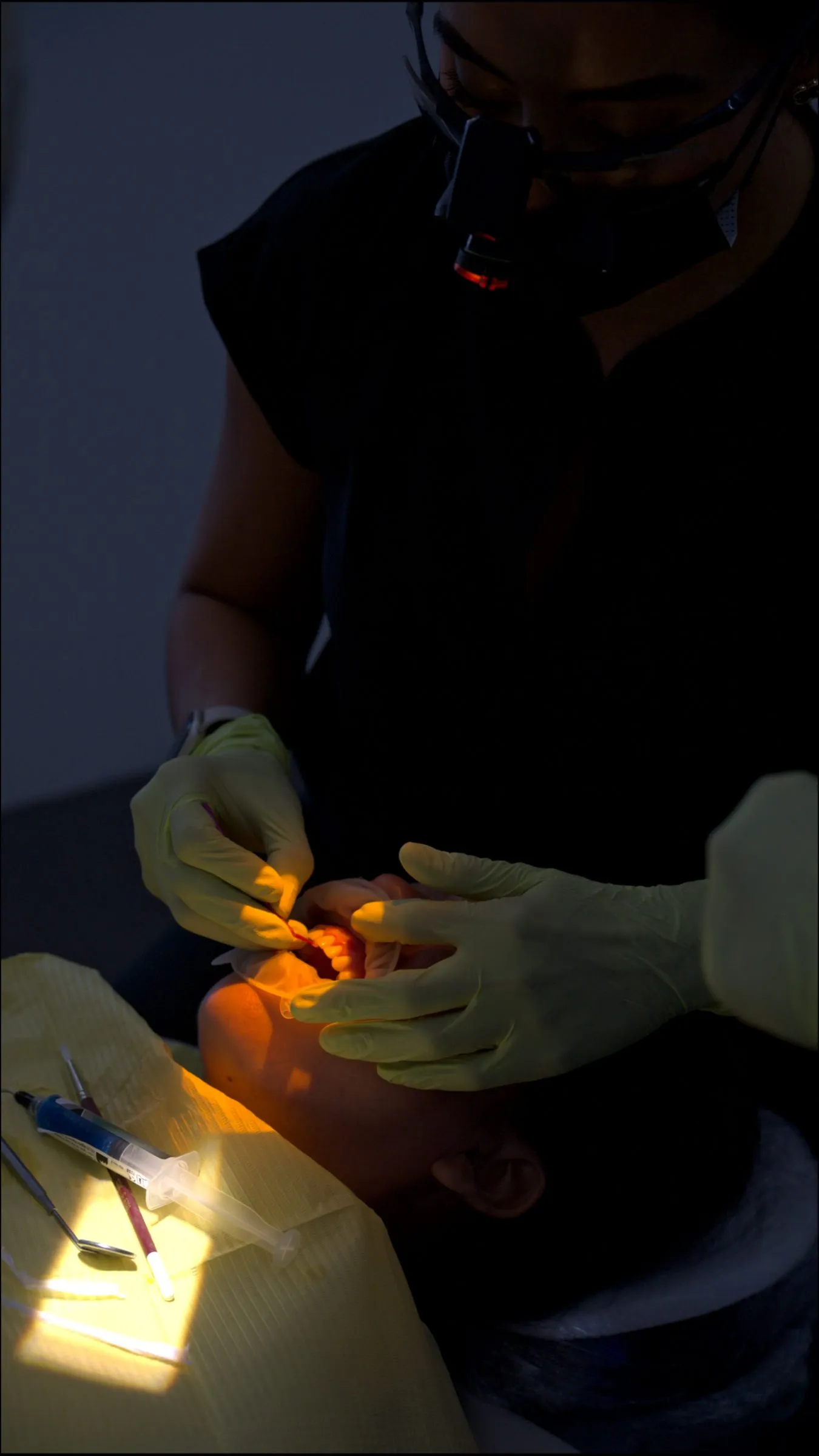 Dentista con cubrebocas y lupas aplica una lámpara de fotocurado en la boca de un paciente, en un consultorio con luz tenue.