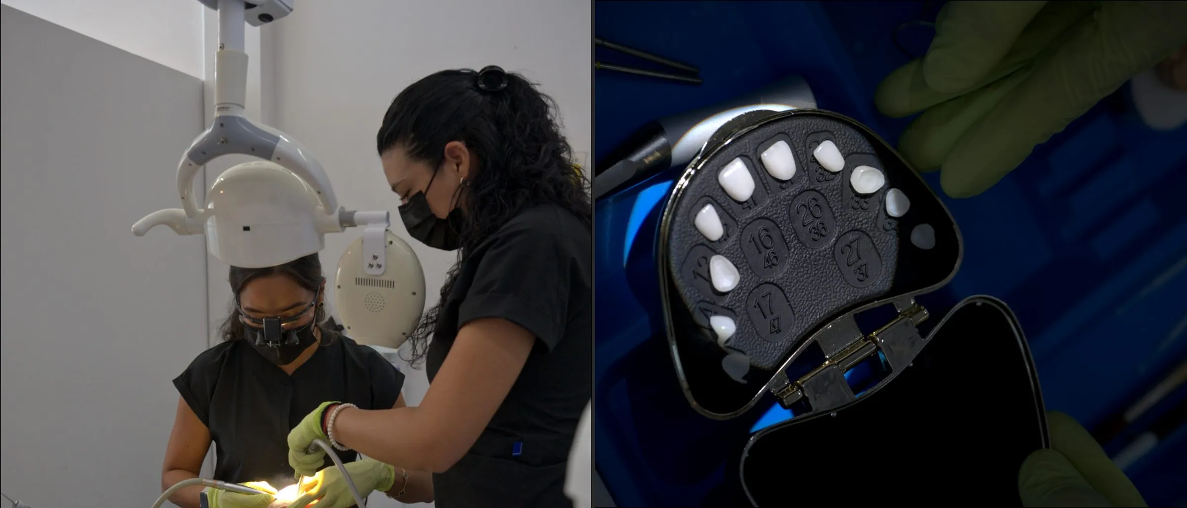Video para dentistas: el material que convence a un paciente de turismo dental antes de viajar
